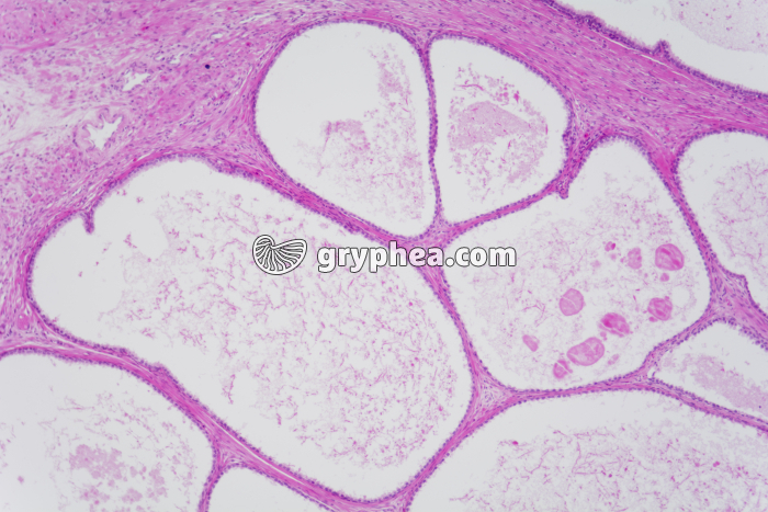 Prostate x25 - gryphea.com